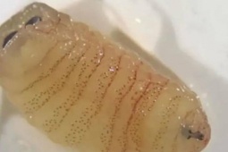 Người phụ nữ hắt hơi ra nhiều con giòi sống