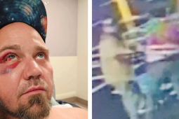 Kẻ trộm kiện ngược nhân viên siêu thị vì bị đuổi đánh