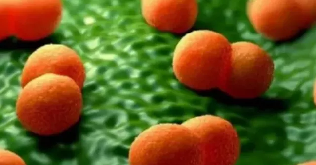 Cà Mau báo cáo 3 người nghi mắc não mô cầu,1 trường hợp đã tử vong