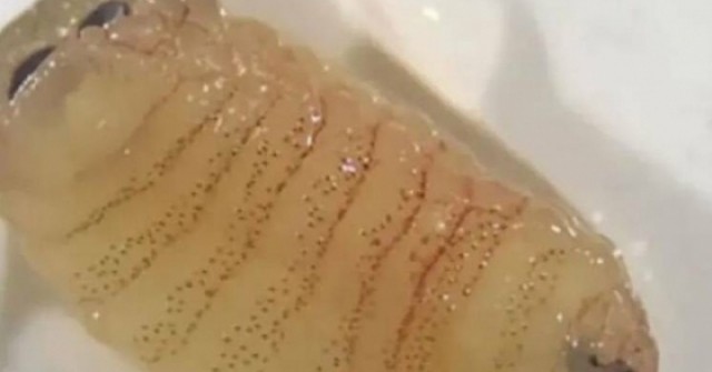 Người phụ nữ hắt hơi ra nhiều con giòi sống