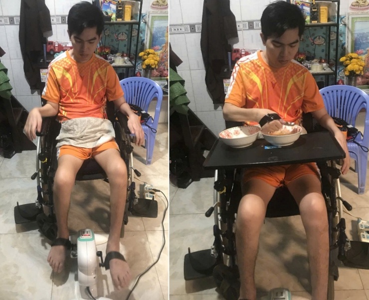 Anh có thể tự tập một số bài tập đơn giản và tự ăn