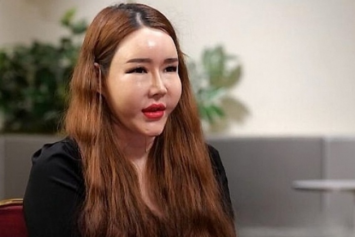 Thảm họa dao kéo Hàn 'muốn phẫu thuật thêm'