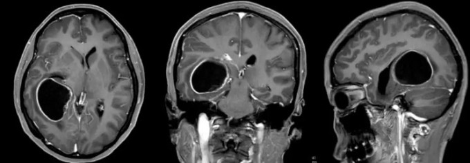 Kết quả chụp chiếu trước phẫu thuật của bệnh nhân Lâm. Ảnh: Ycwb