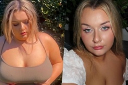 Giảm 20 kg trong một năm nhờ đi bộ quanh sở thú