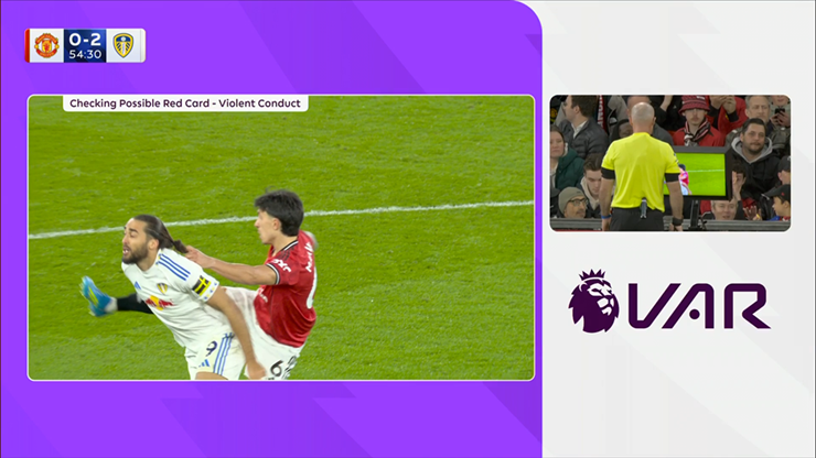 Martinez bị truất quyền thi đấu vì giật tóc Calvert Lewin