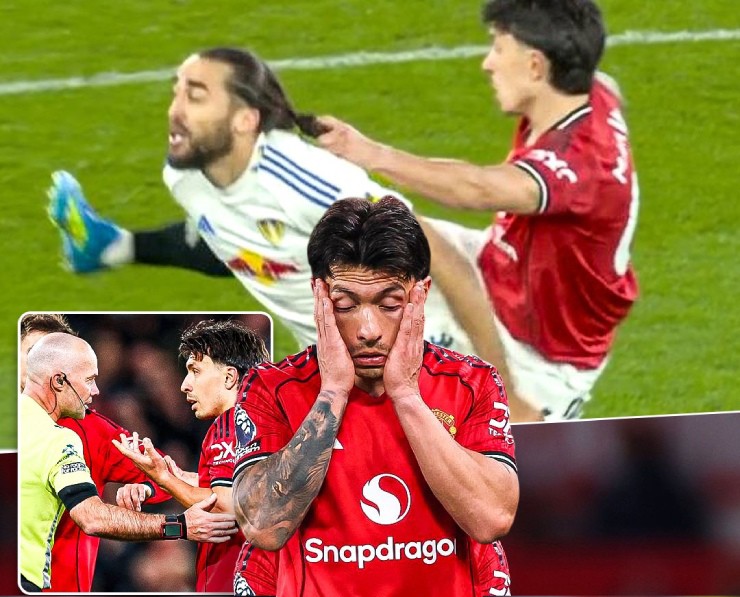 Martinez và tình huống "xấu chơi" với&nbsp;Calvert-Lewin