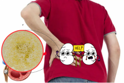 Tin tức sức khỏe - 6 dấu hiệu bất thường khi đi tiểu: Cảnh báo bệnh lý tiết niệu nguy hiểm đừng ngó lơ!