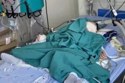 Nuốt nhầm hóa chất thí nghiệm, bé 2 tuổi nhập viện lọc máu