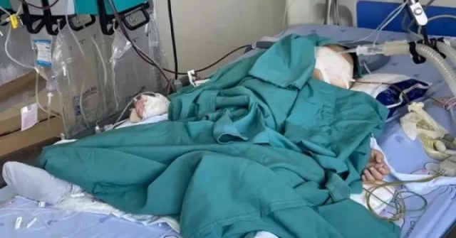 Nuốt nhầm hóa chất thí nghiệm, bé 2 tuổi nhập viện lọc máu