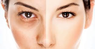 Sau Hydroquinone, người dùng nên kỳ vọng gì ở một sản phẩm làm sáng da lành tính? - 2