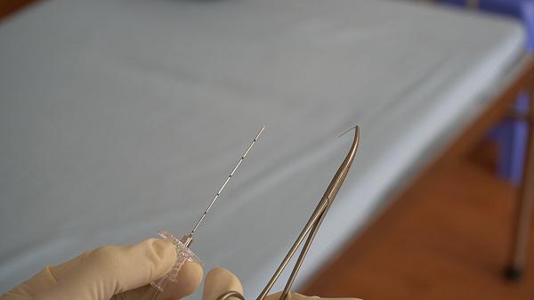 Giải mã phương pháp cấy chỉ cùng THS. BS Ngô Quang Hùng - 1