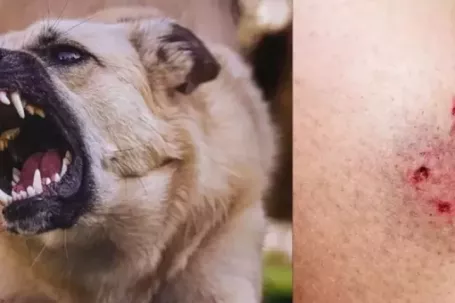 Chó 'điên' cắn 4 người ở Quảng Ngãi dương tính vi rút dại