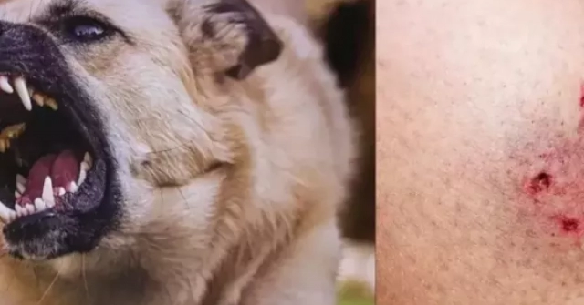 Chó "điên" cắn 4 người ở Quảng Ngãi dương tính vi rút dại