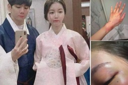 Anh trai Jisoo bị vợ cũ tố 'đánh đập, bạo hành tình dục dã man'