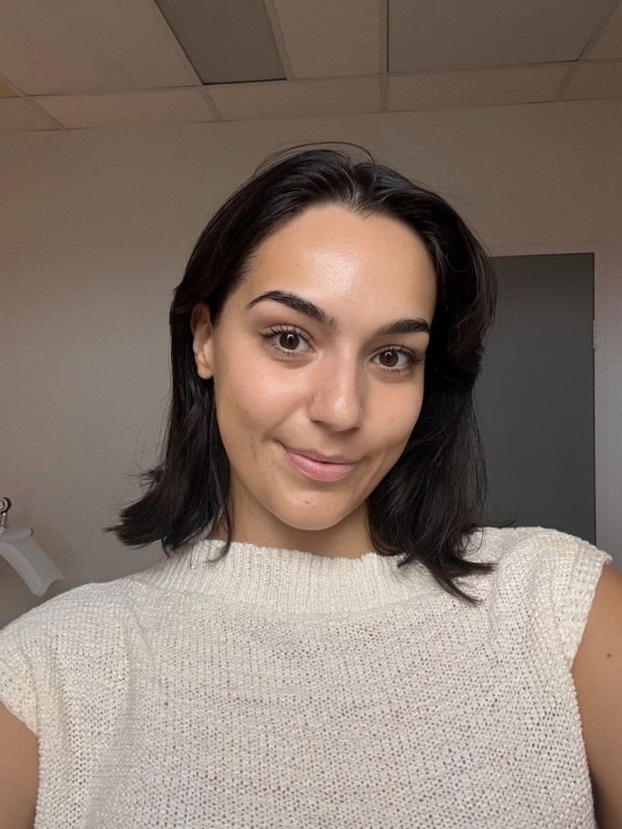 Cô gái 26 tuổi bị ngứa, mất ngủ kéo dài. Ảnh: Instagram