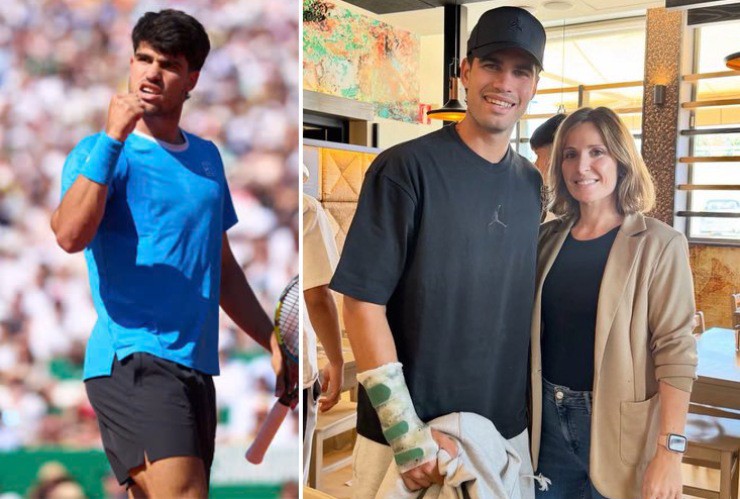 Alcaraz vẫn phải nẹp cổ tay và chưa thể tập luyện trở lại