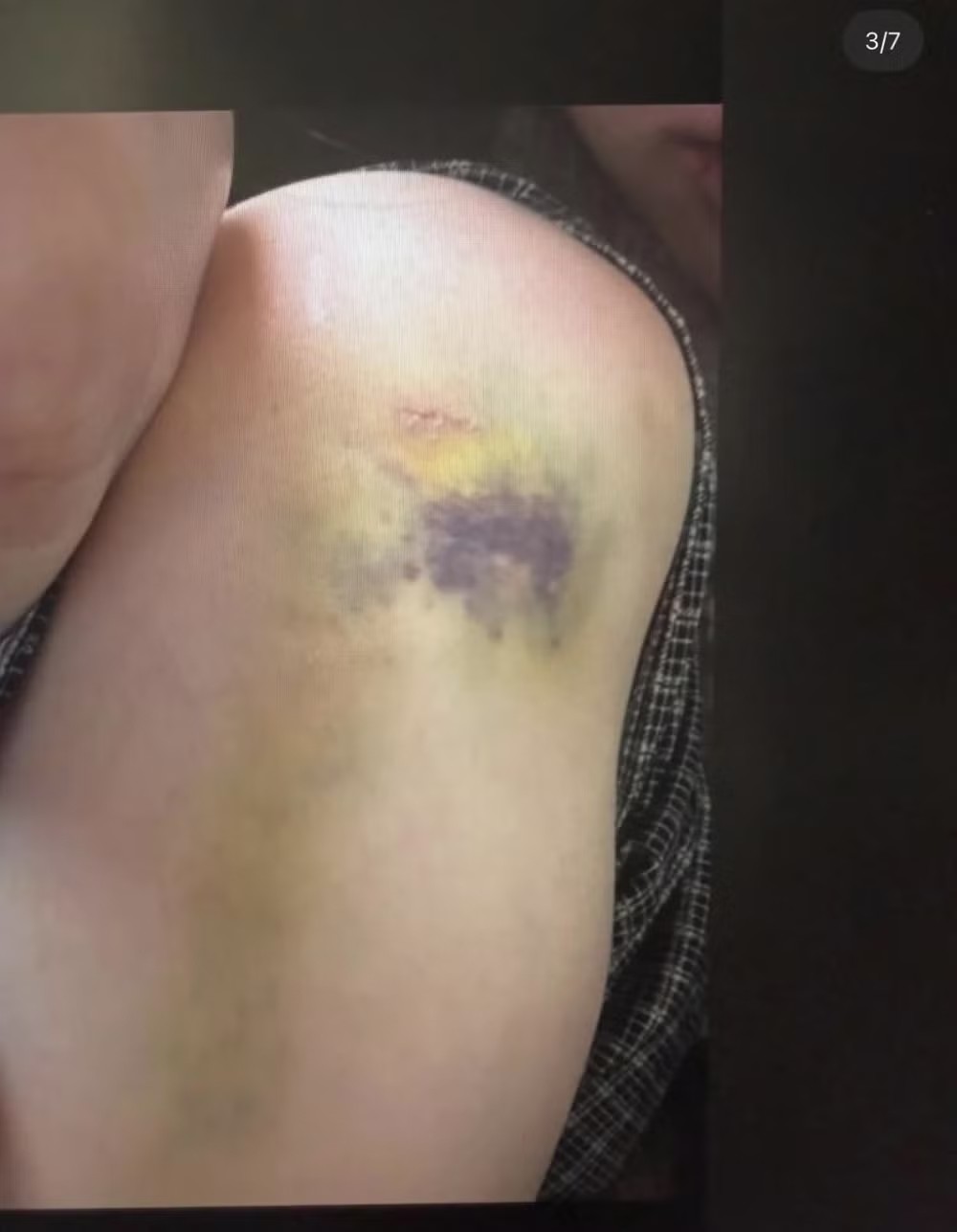 Một số ảnh chụp được cho là bằng chứng Kim hành hung vợ.