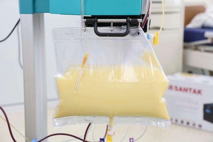 Huyết tương đục như nước gạo.