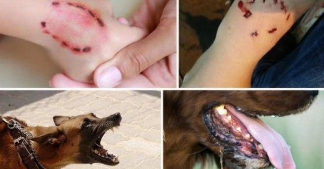 3 người bị chó dại cắn tử vong, TPHCM cảnh báo nóng