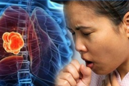 2 dấu hiệu khi ho cảnh báo ung thư phổi dễ bị bỏ qua