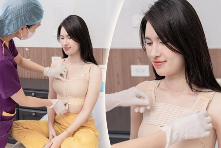 Xu hướng nâng ngực chuẩn y khoa được chuyên gia khuyến nghị hiện nay