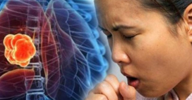 2 dấu hiệu khi ho cảnh báo ung thư phổi dễ bị bỏ qua