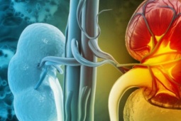 Loại củ quen thuộc đang bán nhiều ở chợ Việt, người bệnh suy thận cần lưu ý khi ăn để ngừa biến chứng