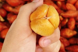 Tin tức sức khỏe - Trào ngược dạ dày đang khiến hàng triệu người khắp Việt Nam khổ sở, chỉ vì một sai lầm duy nhất