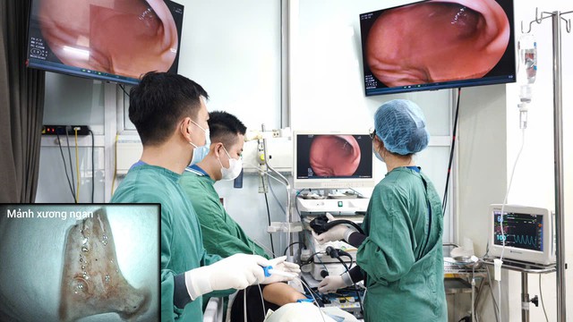 Các bác sĩ tiến hành phẫu thuật nội soi gắp mảnh xương ngan cho bệnh nhân.