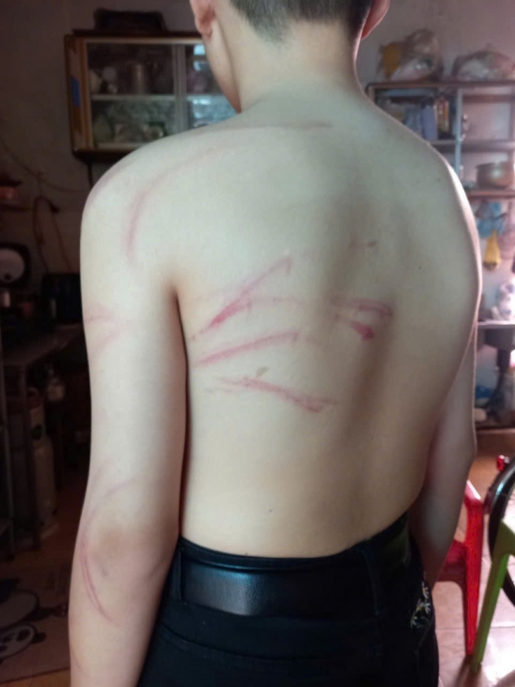 Học sinh bị thầy dạy thêm đánh bằng cành cây.