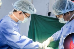 Chia sẻ của người đàn ông 42 tuổi phát hiện mắc ung thư tuyến giáp di căn: Không có triệu chứng