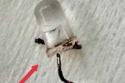 Bác sĩ thót tim gắp đèn LED nằm trong phế quản bé 9 tháng tuổi