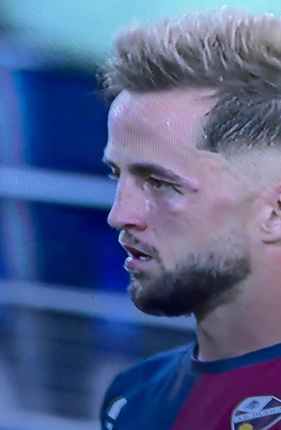 Khuôn mặt của&nbsp;Pulido bị sưng sau khi lĩnh cú đấm của đối thủ