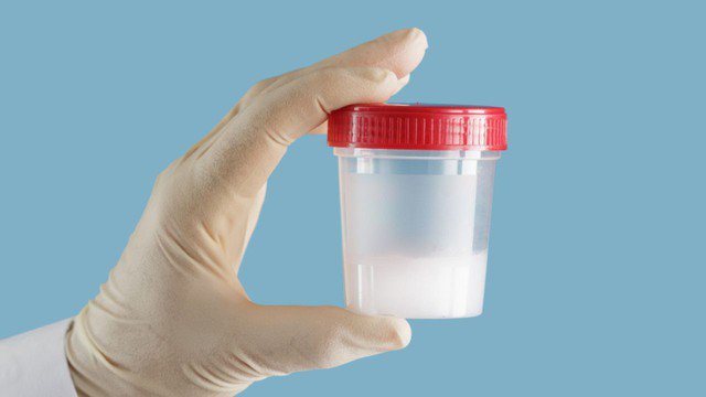 Tinh dịch liên quan đến sức khỏe vì thế không nên lơ là các biện pháp an toàn.