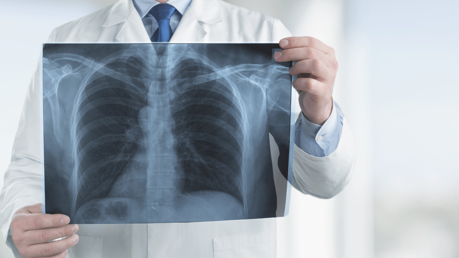 Uống trà xanh có tốt cho phổi? Câu trả lời khiến nhiều người bất ngờ! - 4