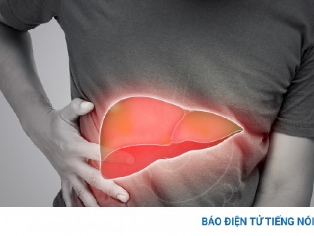 6 dấu hiệu cảnh báo gan nhiễm mỡ, nhiều người hay gặp nhưng lại ngó lơ