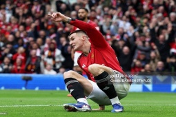 Bóng đá - MU trả giá đắt cho chiến thắng Liverpool, Sesko chấn thương ra sao?