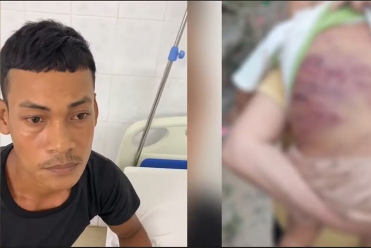 Lời khai của gã cha dượng trong vụ bé trai 2 tuổi bị bạo hành đến nguy kịch