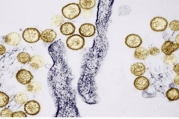 Dịch bệnh bùng phát trên tàu xuyên Đại Tây Dương: Sự nguy hiểm của virus Hanta