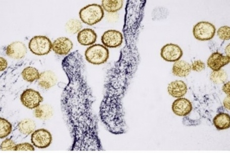 Dịch bệnh bùng phát trên tàu xuyên Đại Tây Dương: Sự nguy hiểm của virus Hanta