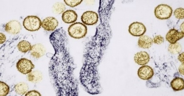 Dịch bệnh bùng phát trên tàu xuyên Đại Tây Dương: Sự nguy hiểm của virus Hanta