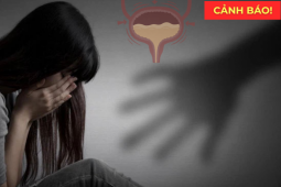 Tin tức sức khỏe - Cảnh báo: Đây mới là “sát thủ giấu mặt” khiến bạn tiểu nhiều, không phải do “thận yếu”!