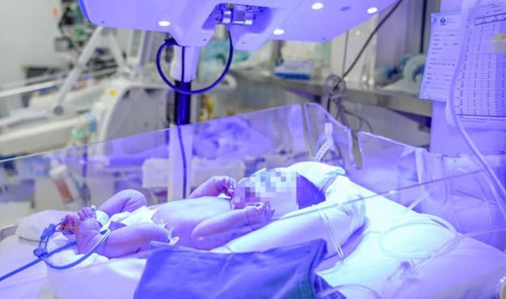 Bé trai 4 ngày tuổi mang nhóm máu cực hiếm (Ảnh: BV Nhi TƯ)