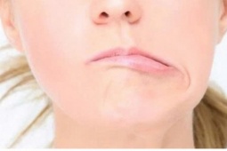Méo miệng, lệch mặt giữa mùa hè: Nguyên nhân ít ai ngờ tới