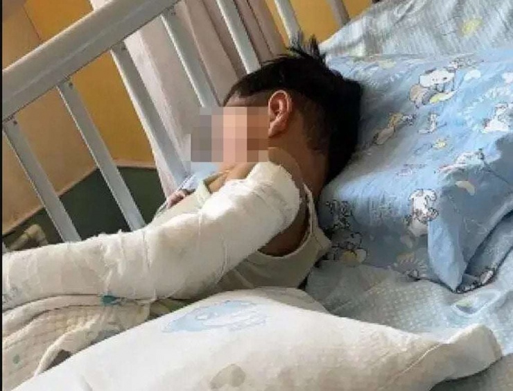 Cậu bé nằm trên giường bệnh sau cú rơi từ tầng 11. Các bác sĩ cho biết cơ hội sống sót của em chỉ khoảng 5%. Ảnh: Sohu