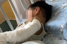 Bé trai 4 tuổi rơi từ tầng 11 vì nhớ mẹ, mở cửa sổ chờ bố mẹ về