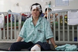 Nạn nhân kể lại phút kinh hoàng lúc xe khách lao xuống vực sâu đèo An Khê, Gia Lai