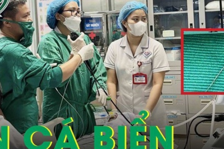 Hiếm gặp: Ăn cá biển, người đàn ông bị lưỡi câu mắc sâu trong thực quản