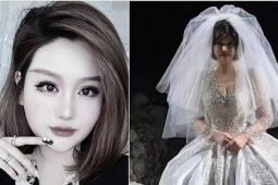 Cô gái 29 tuổi qua đời sau lễ cưới không chú rể