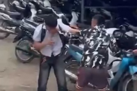 Nam sinh lớp 12 bị nhóm thanh niên mặc quần cộc đột nhập vào trường hành hung